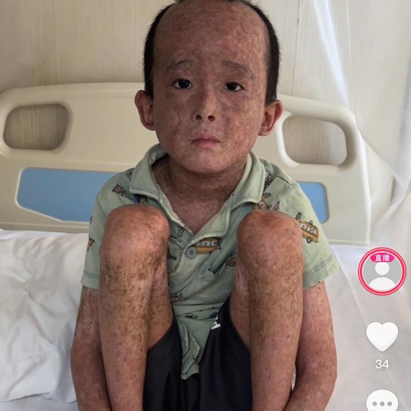 加油