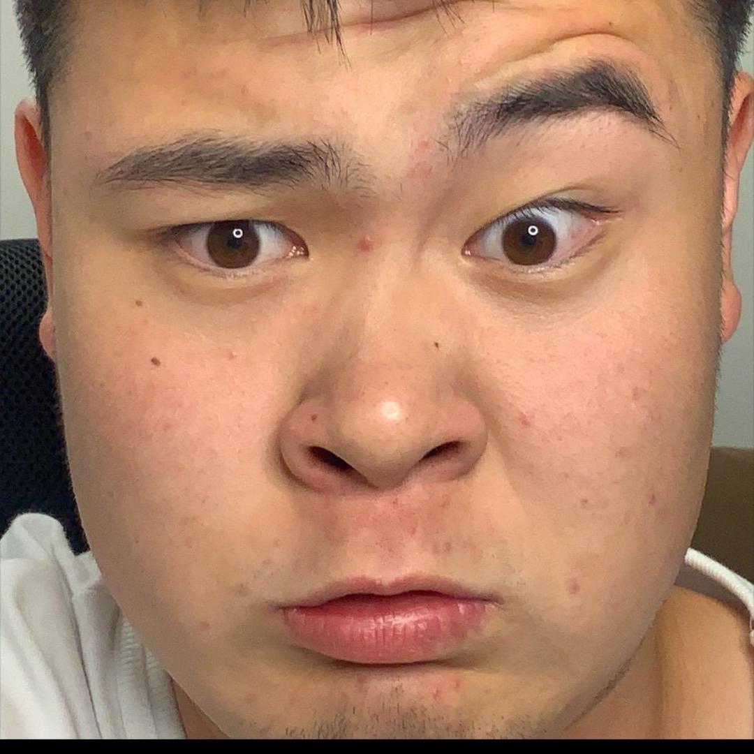 大嘴