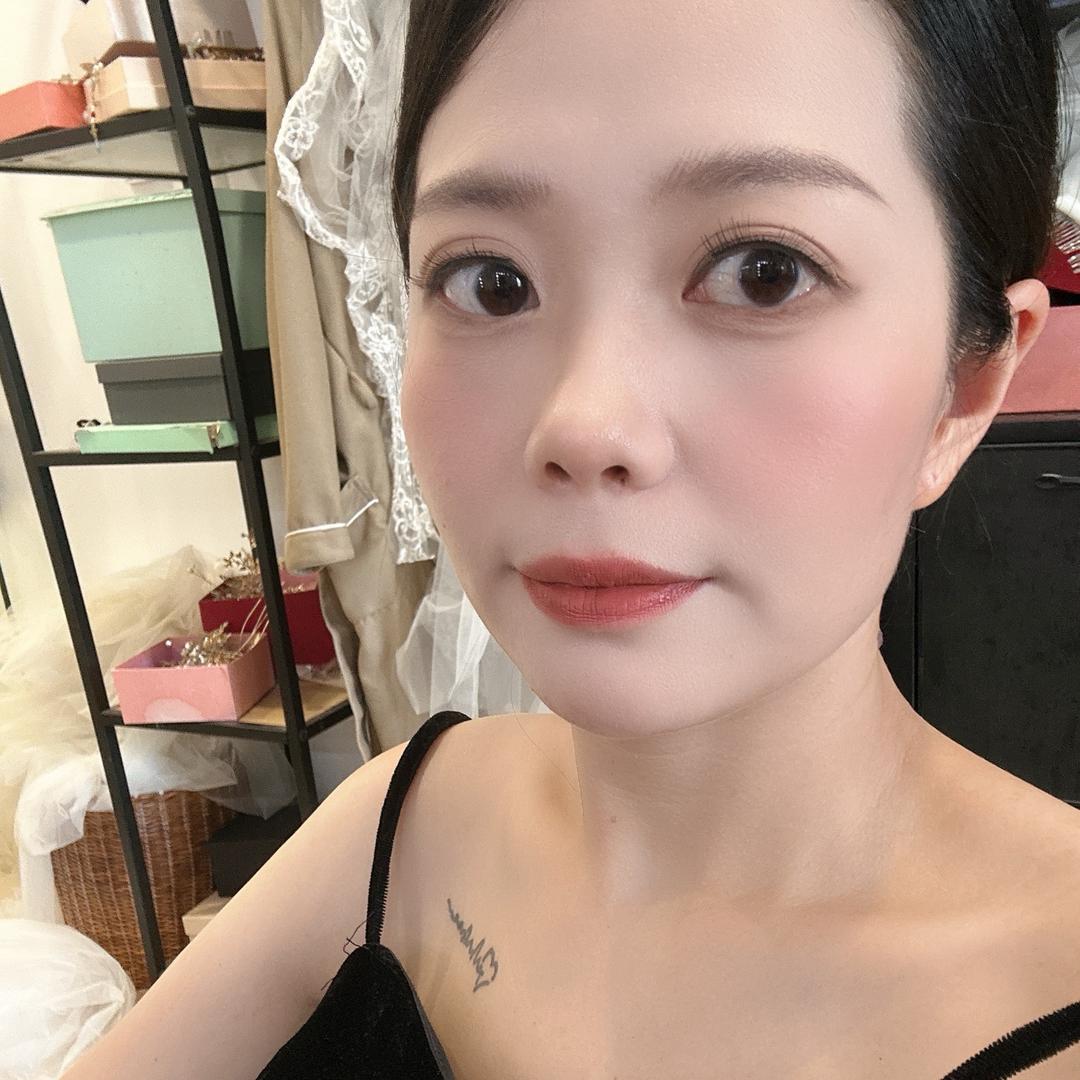 脸上有斑的小姐妹进