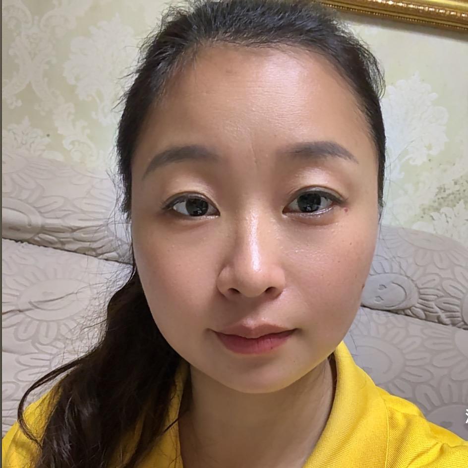 美团无忧（周姐）