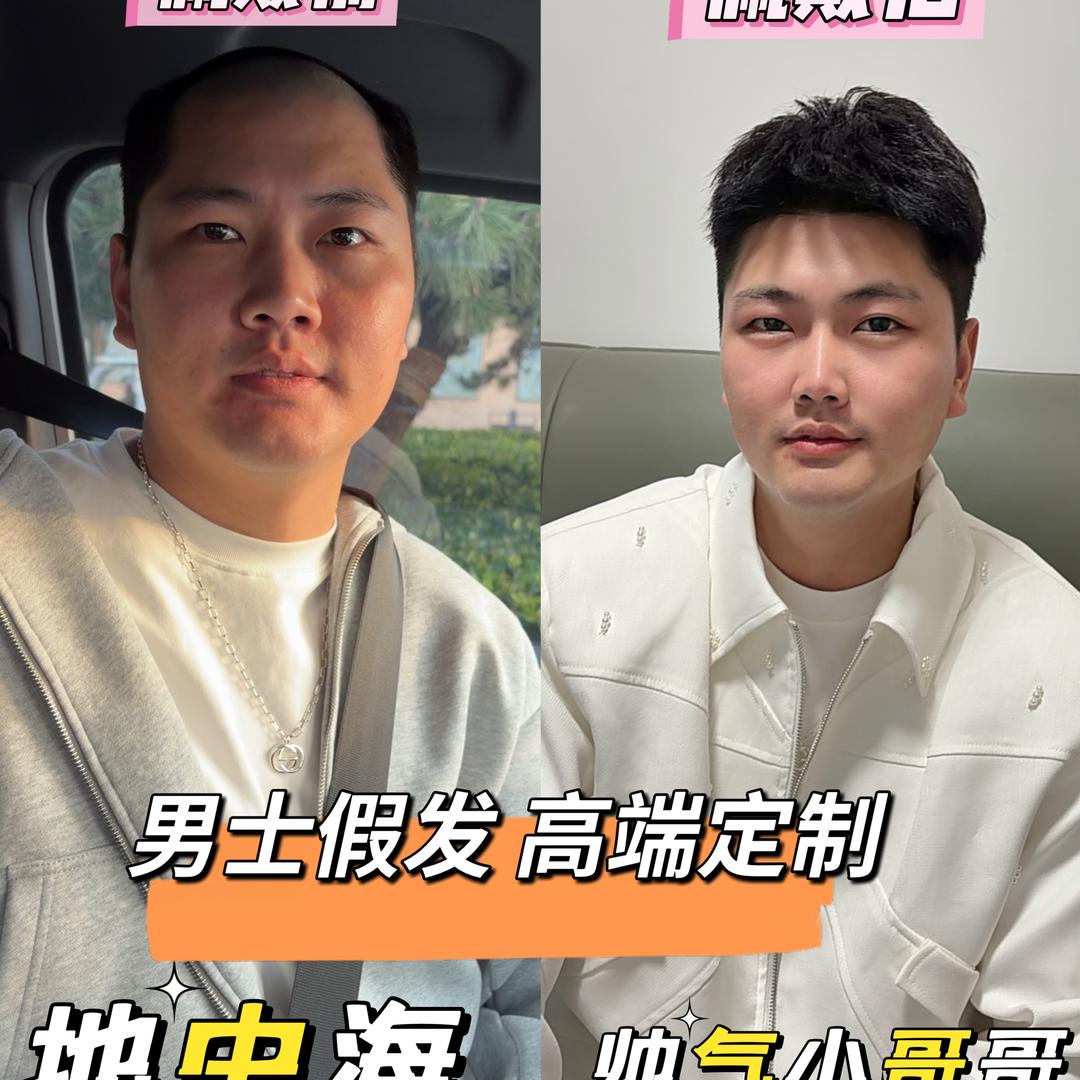 鑫起点男士假发