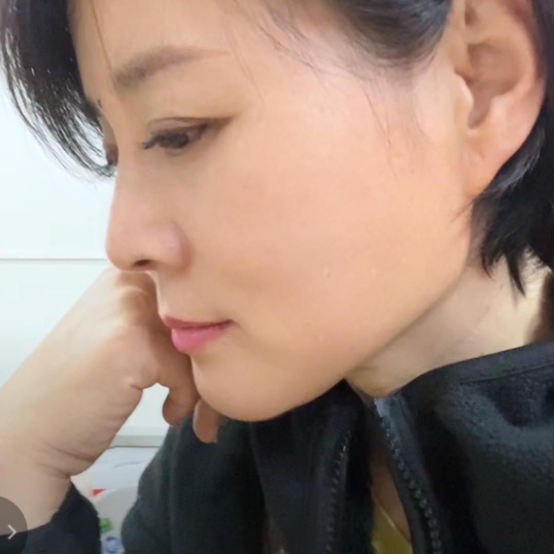 美人痣.