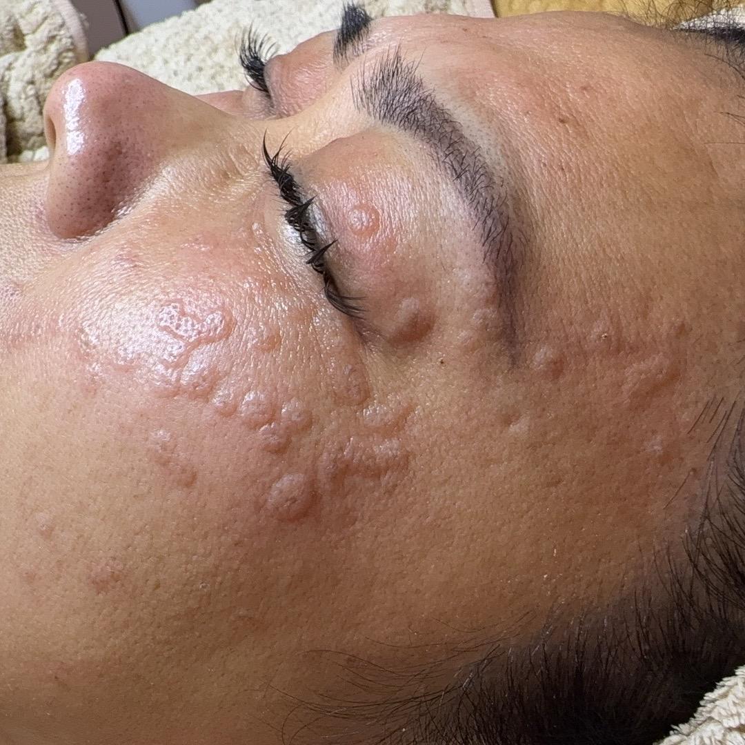 洛阳做脸的婉莹