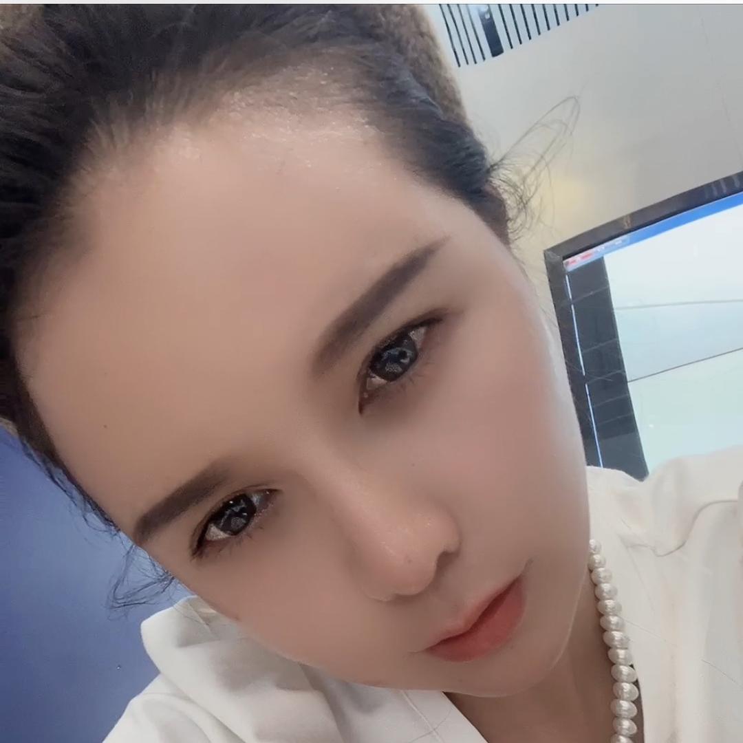 小雨-