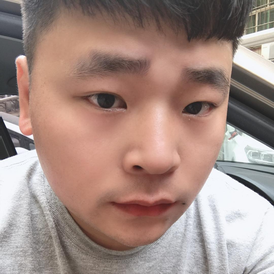 超哥（有三颗痣）