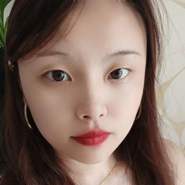 如花  轮椅♿️女孩