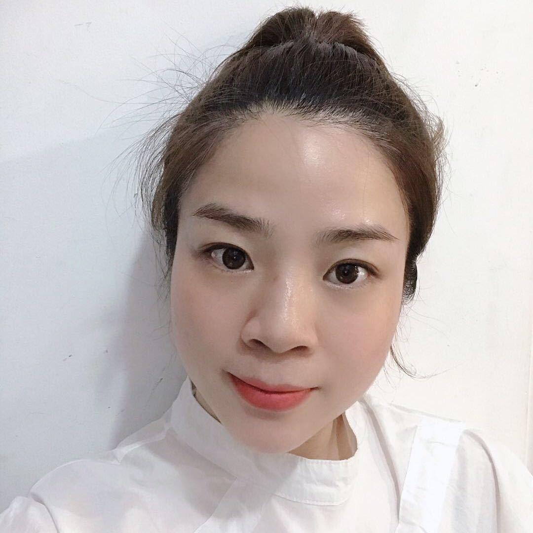 非贝