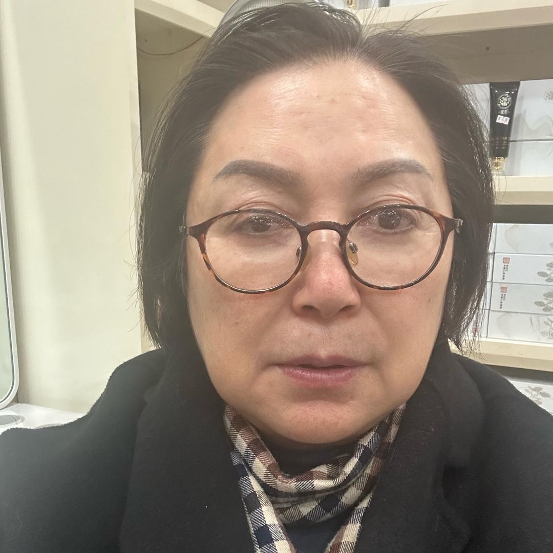 惠姐－成都白养黑