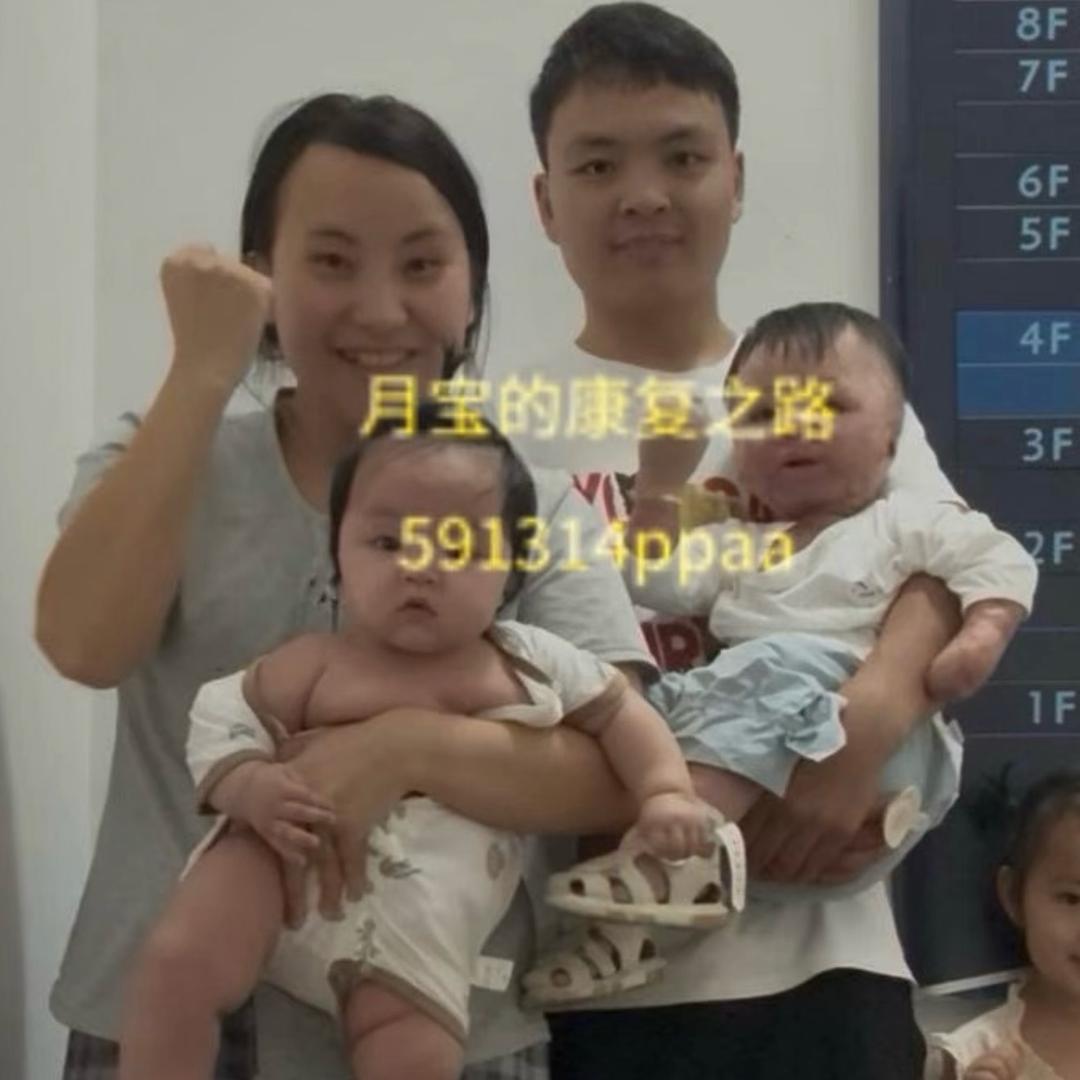 月宝的康复之路（橱窗生活用品）