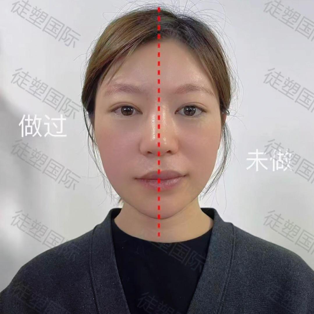 骨相美新时光娱乐圈徒手体态还原