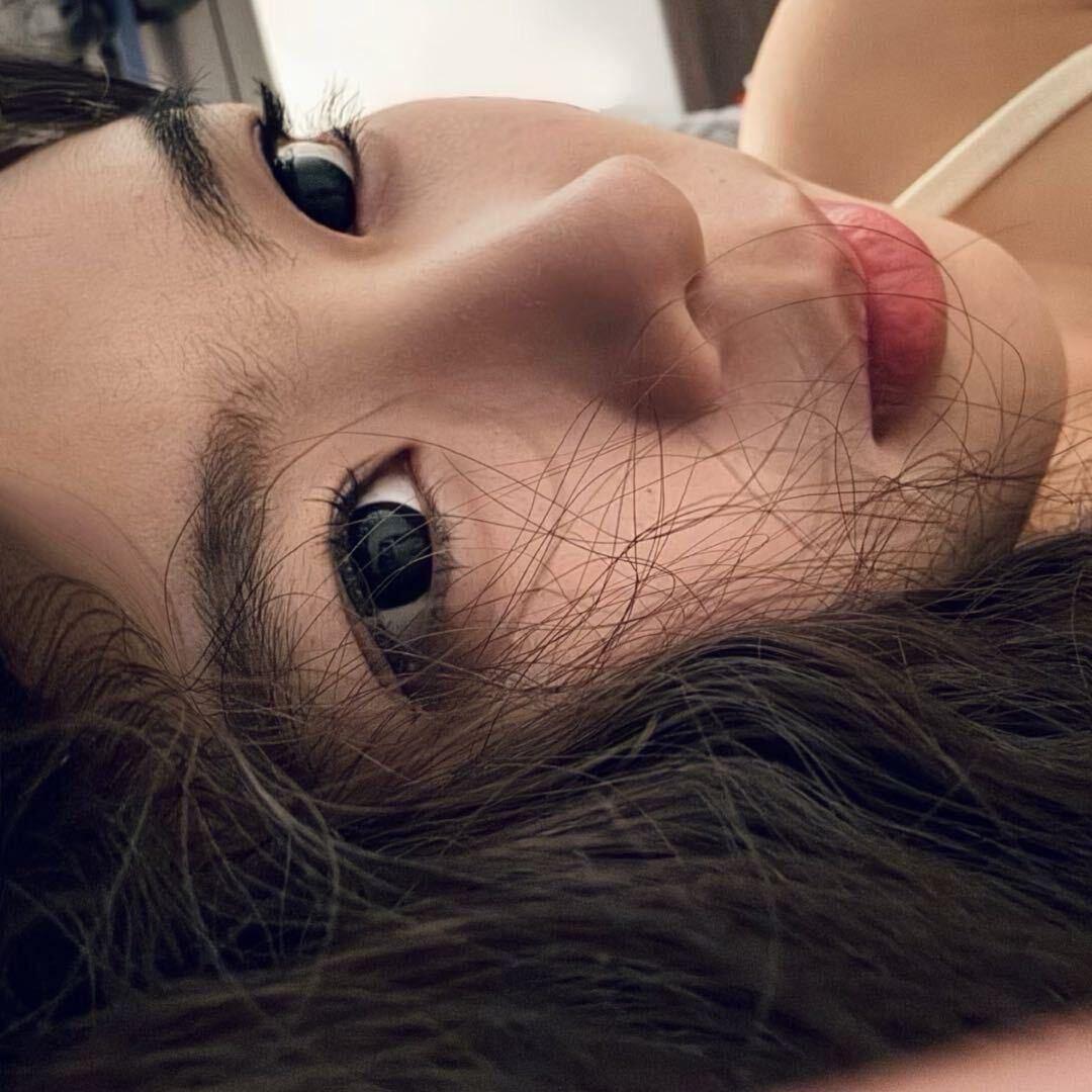 腿毛