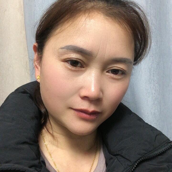 芳