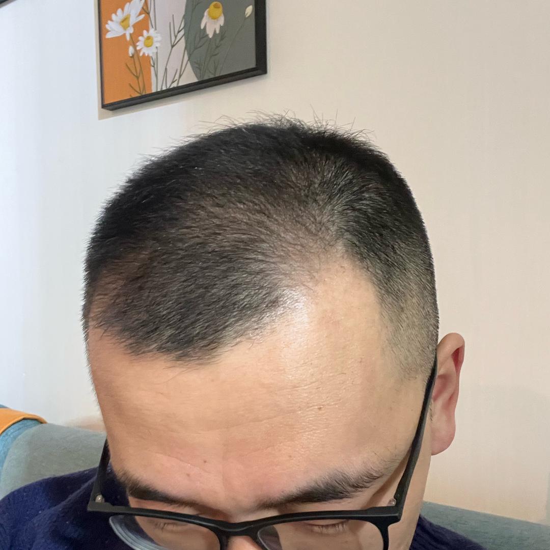 阿超想变帅