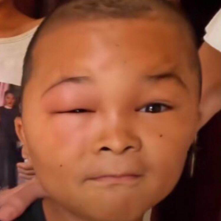 22513273860