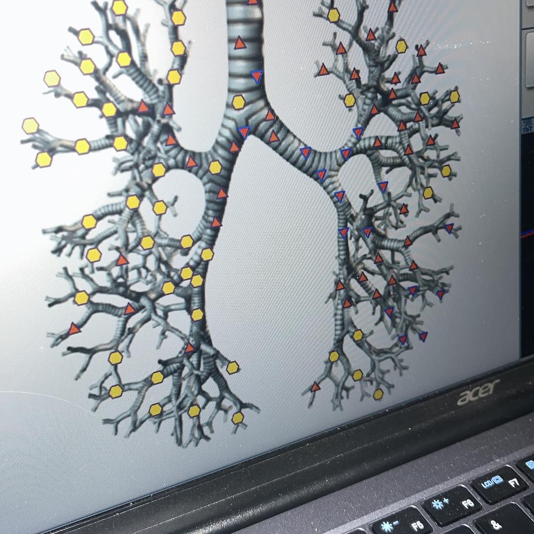 龙卷风摧毁星城