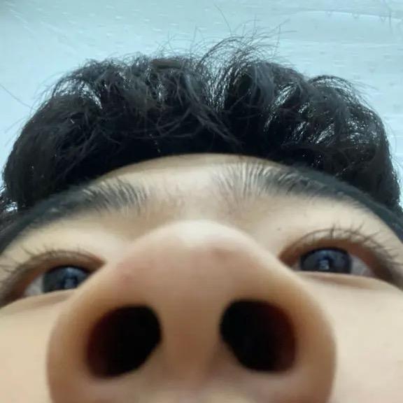姜皮