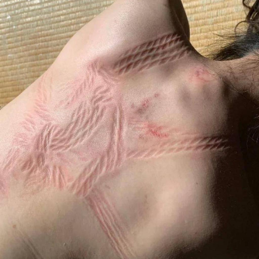 齐缪
