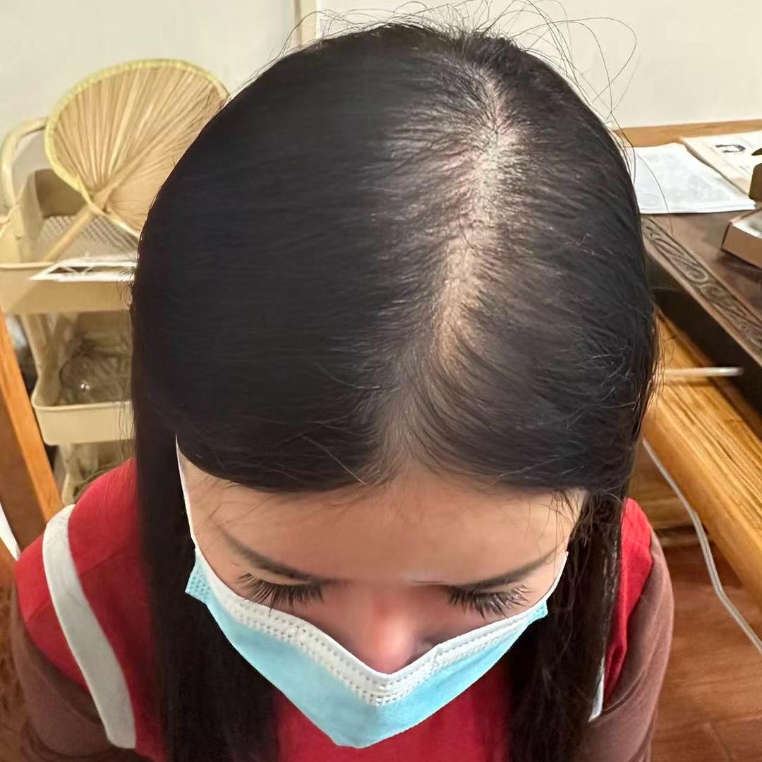 妮妮妈妈带你养发