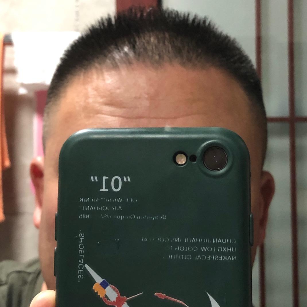 小瓶盖
