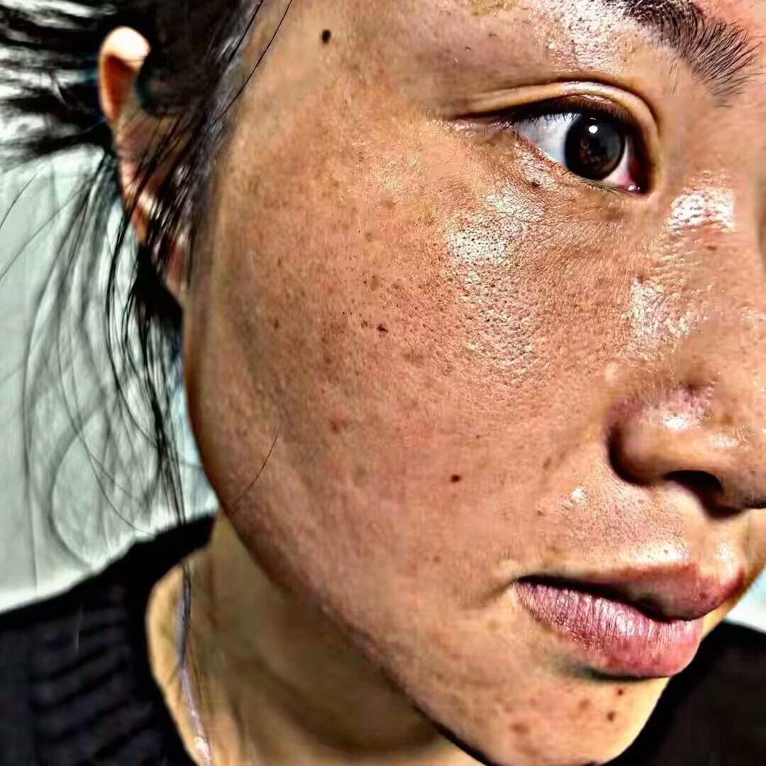 菁奢恒姐专业养斑调痘调闭口店