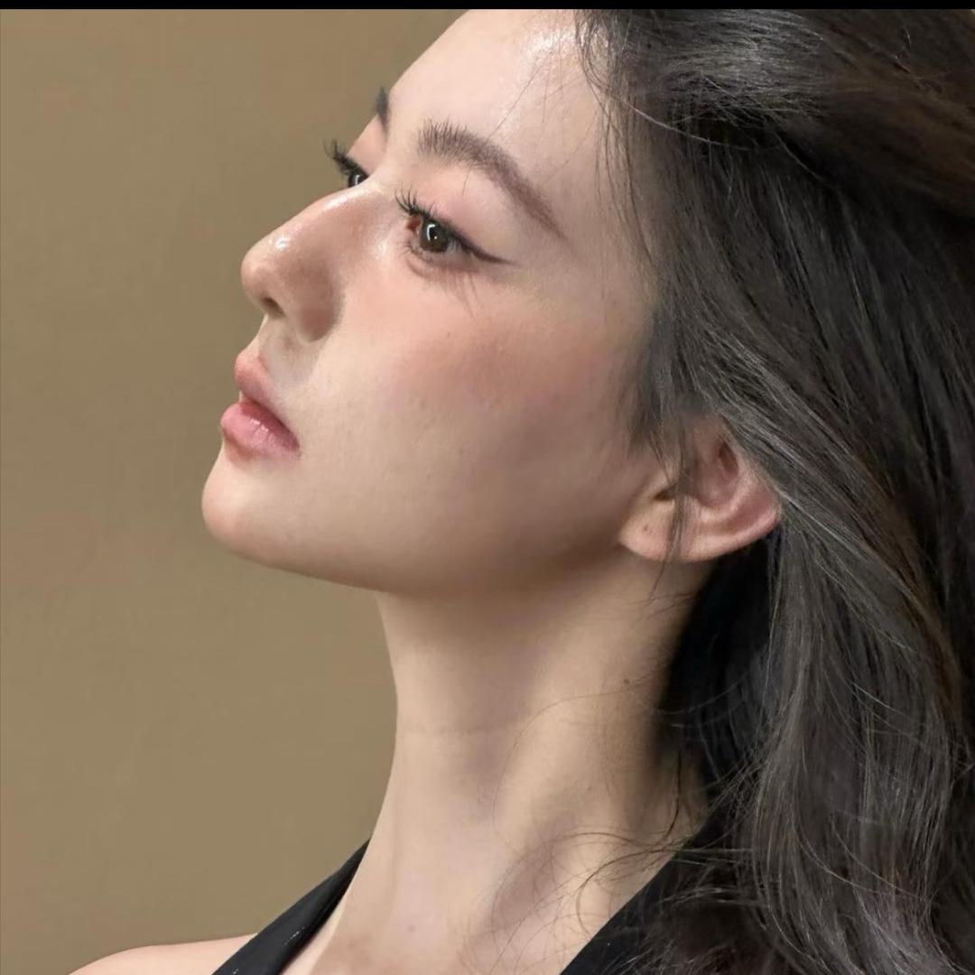玲玲