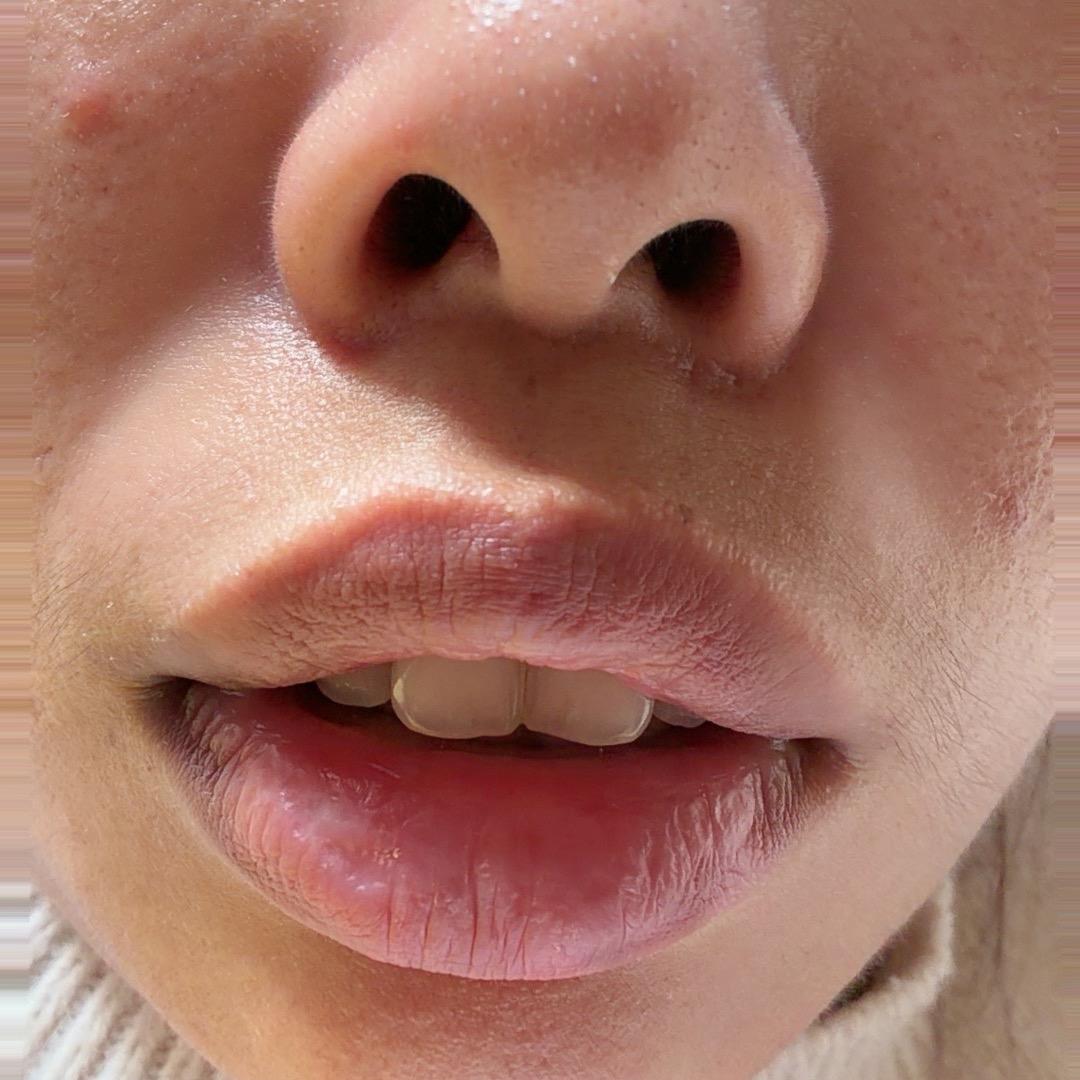 慧娟