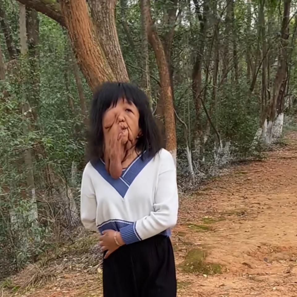 坚强梅梅
