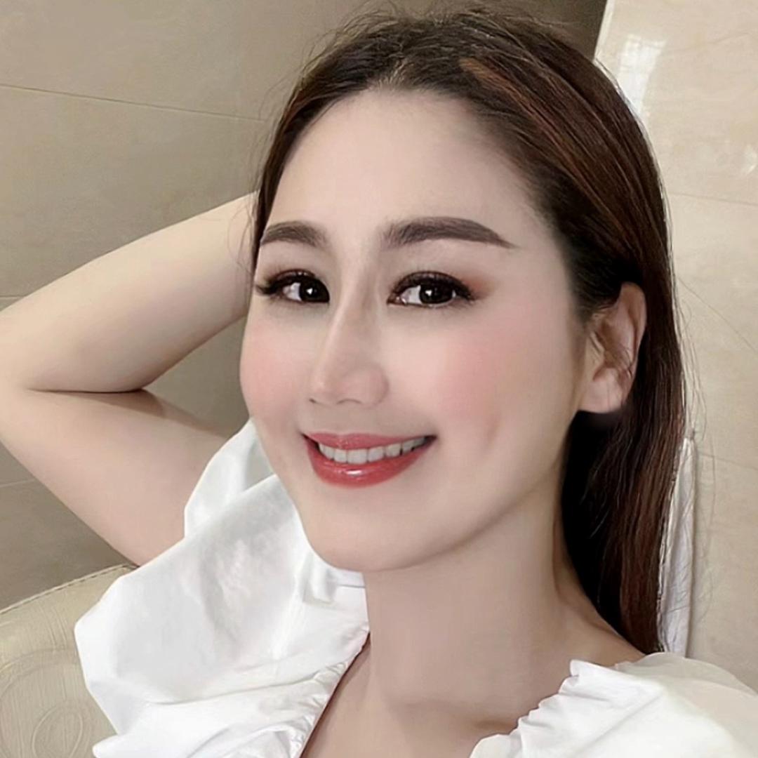 肖晓琪