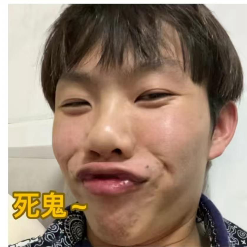 大嘴沛钊