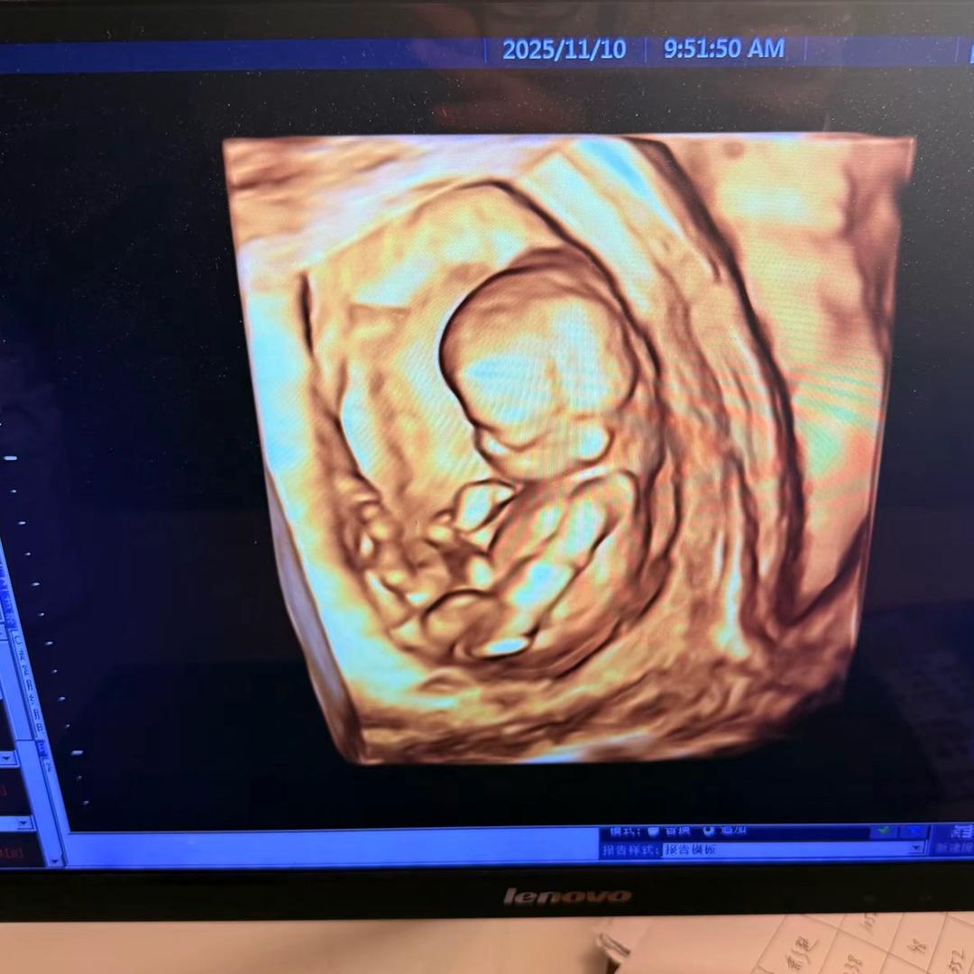 淄博莲池🏥幸福孕产