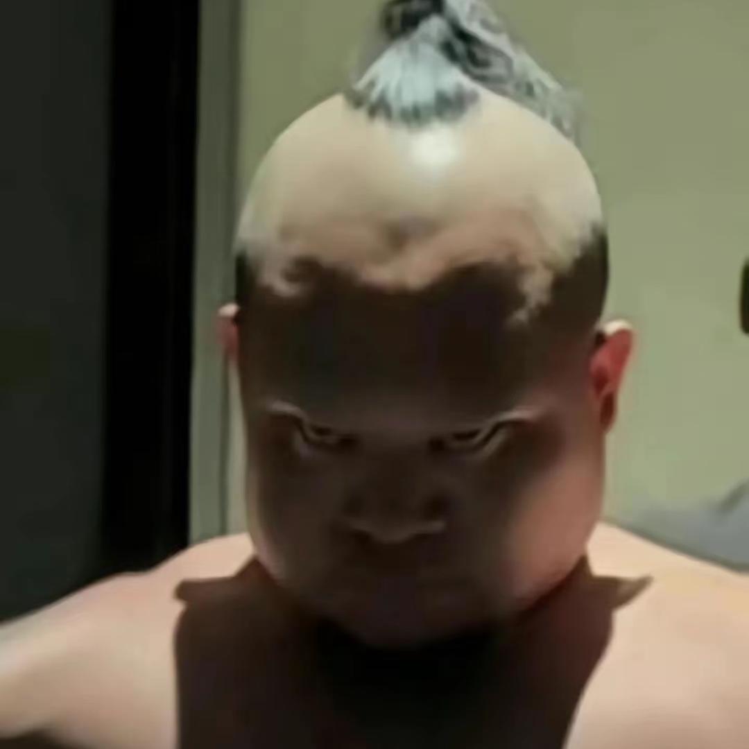 Xxoi