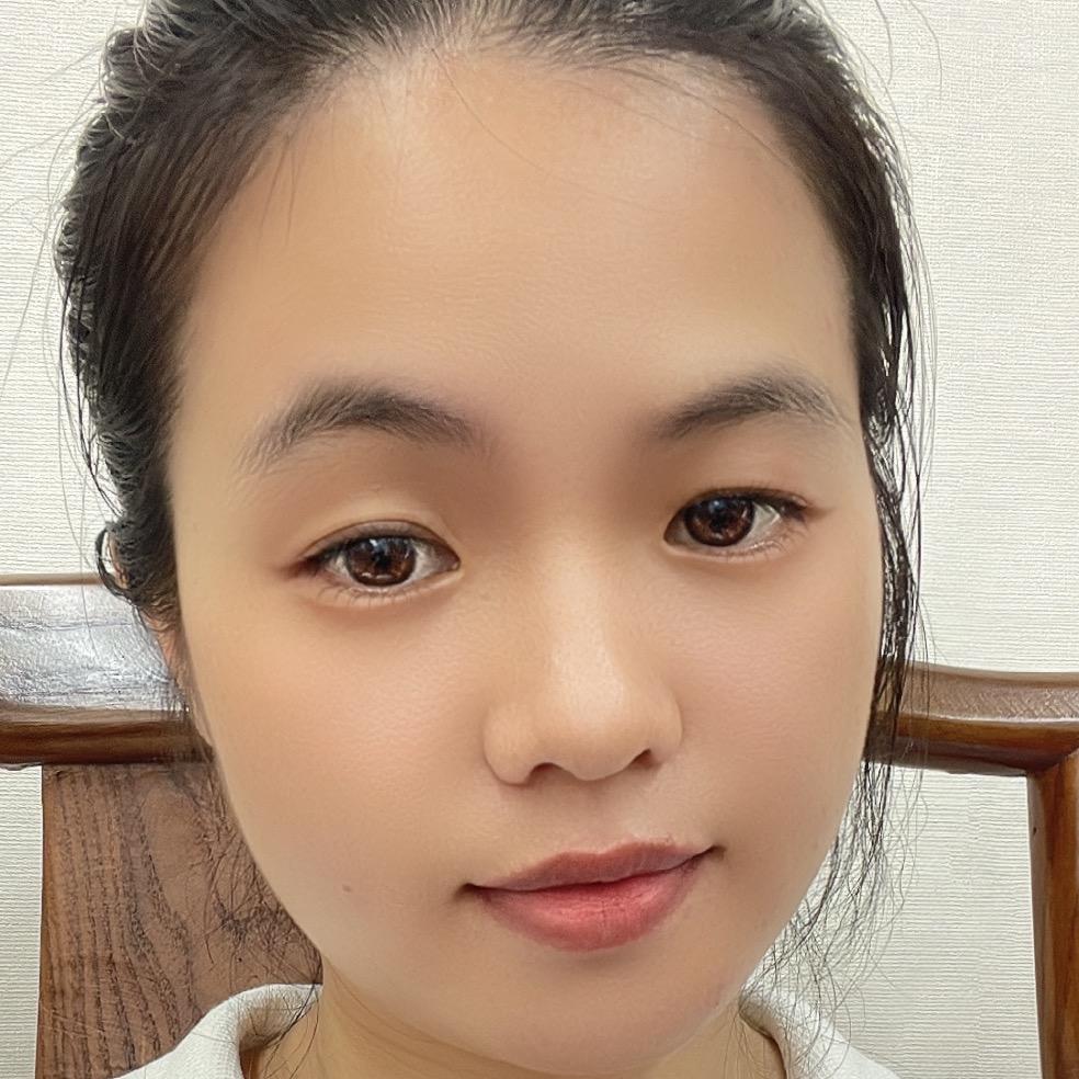 伽璐吖