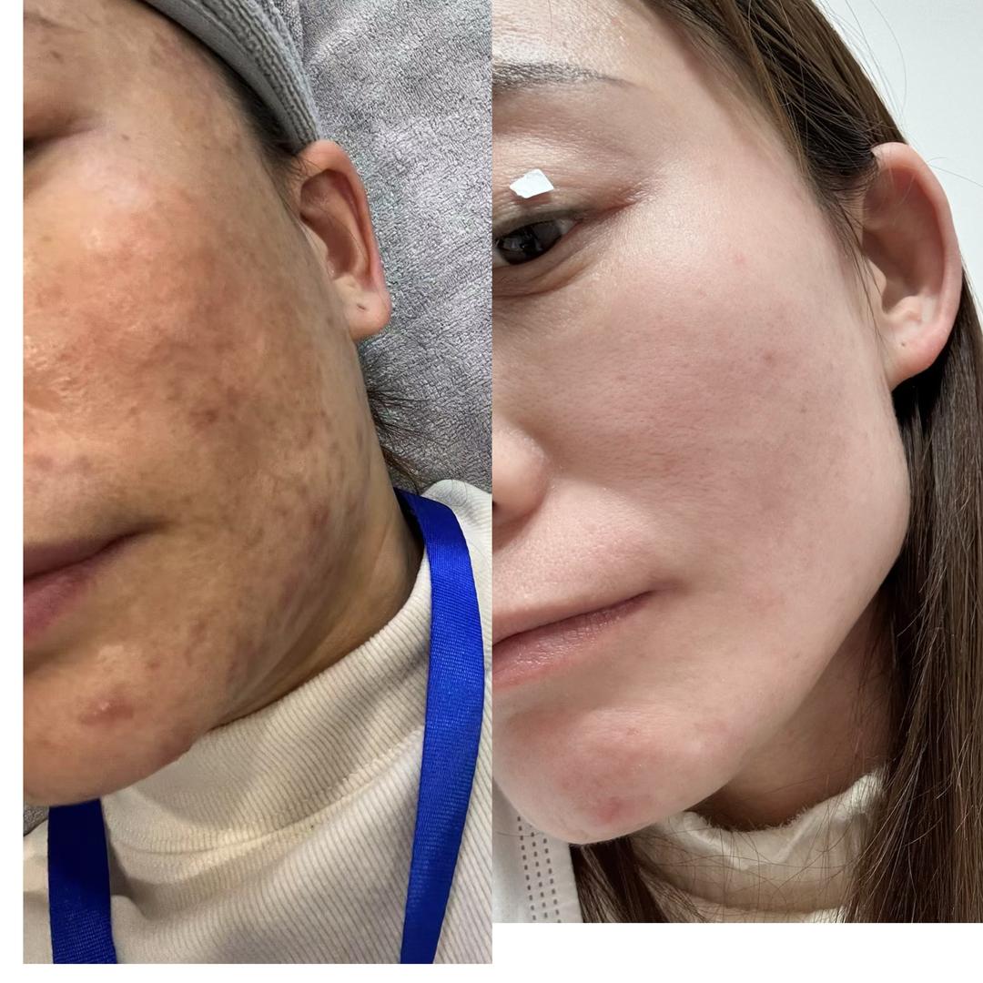 淮南问题肌扛霸子.鹿鹿