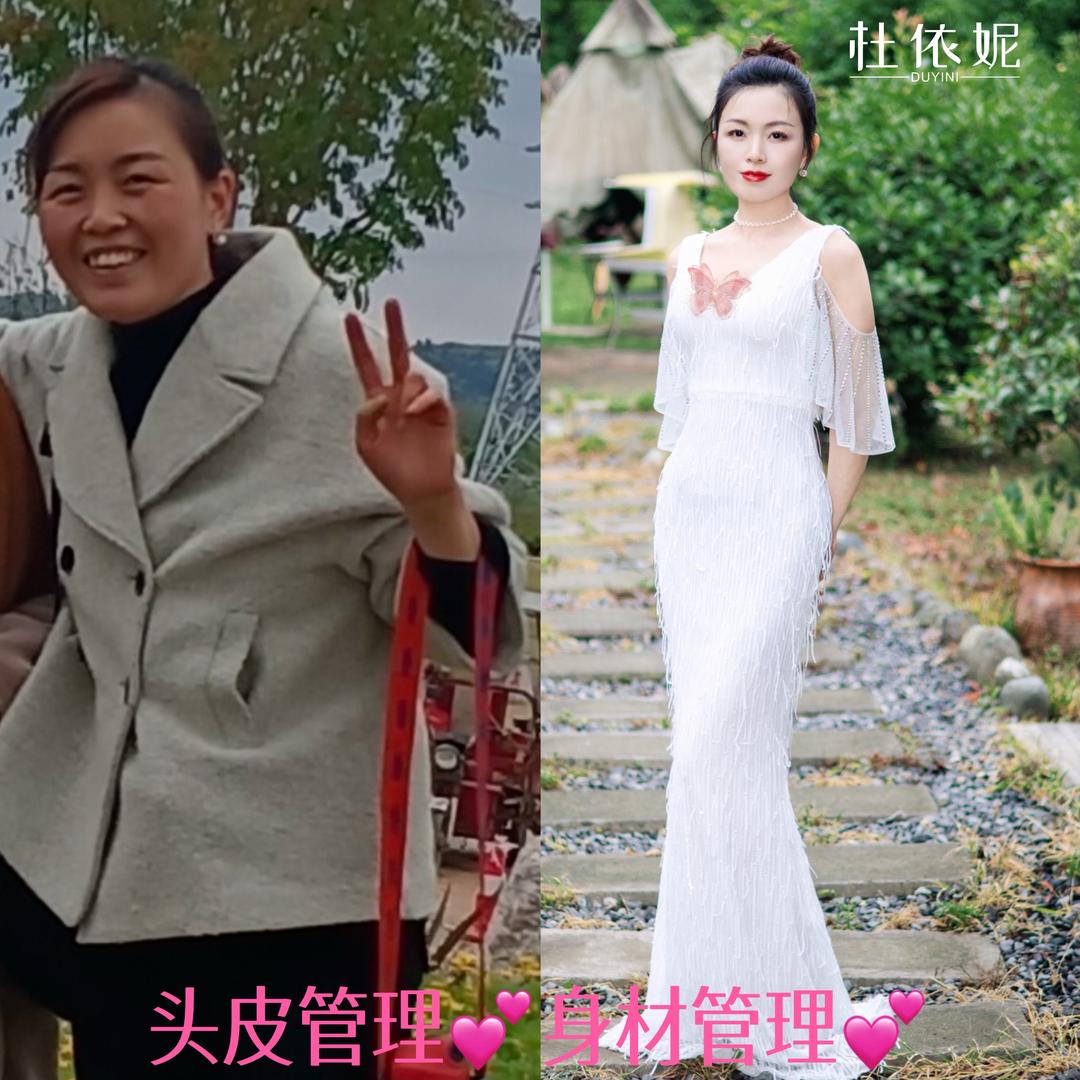 德阳身材管理→头皮管理🌻红梅