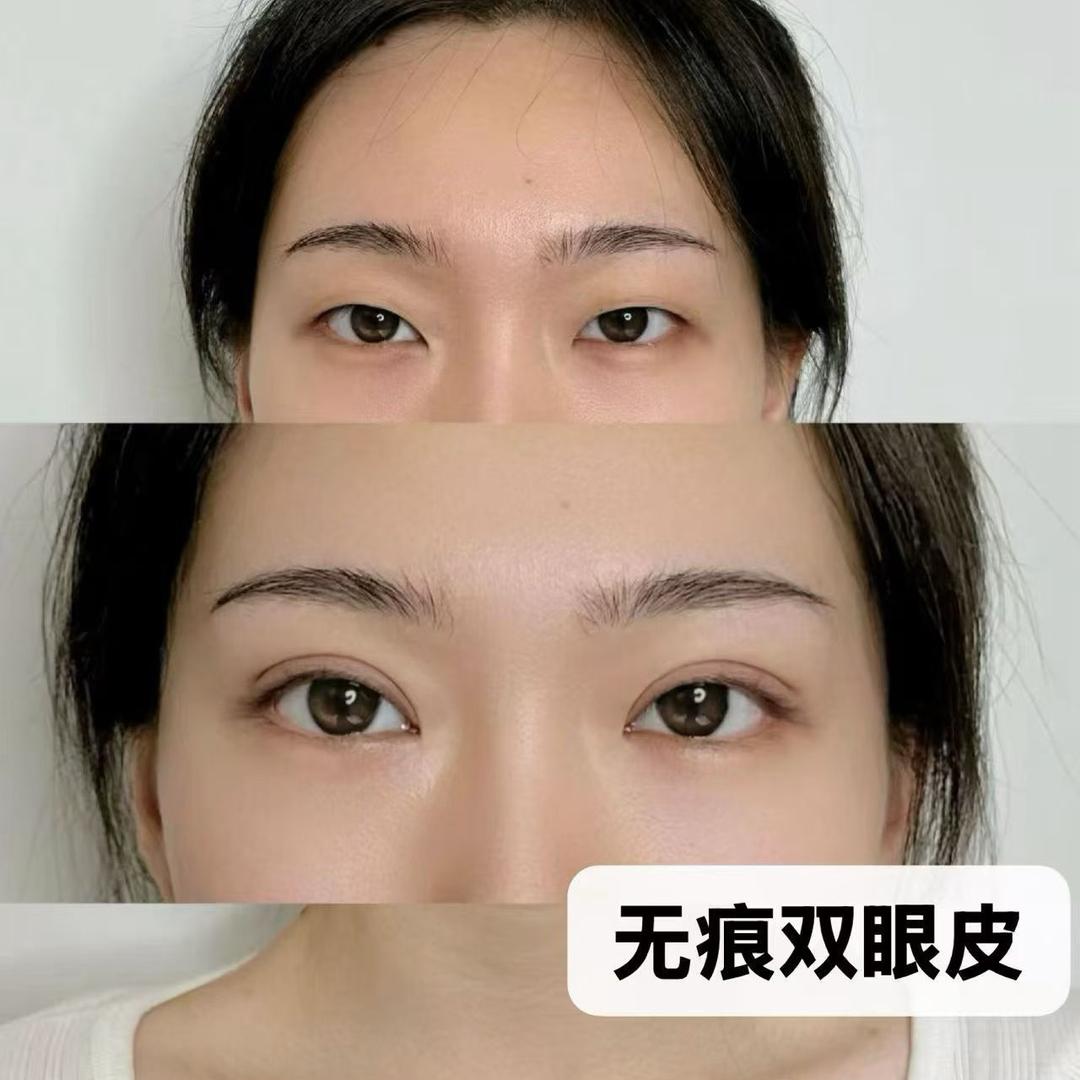 宁晋眉眼唇『招学员』