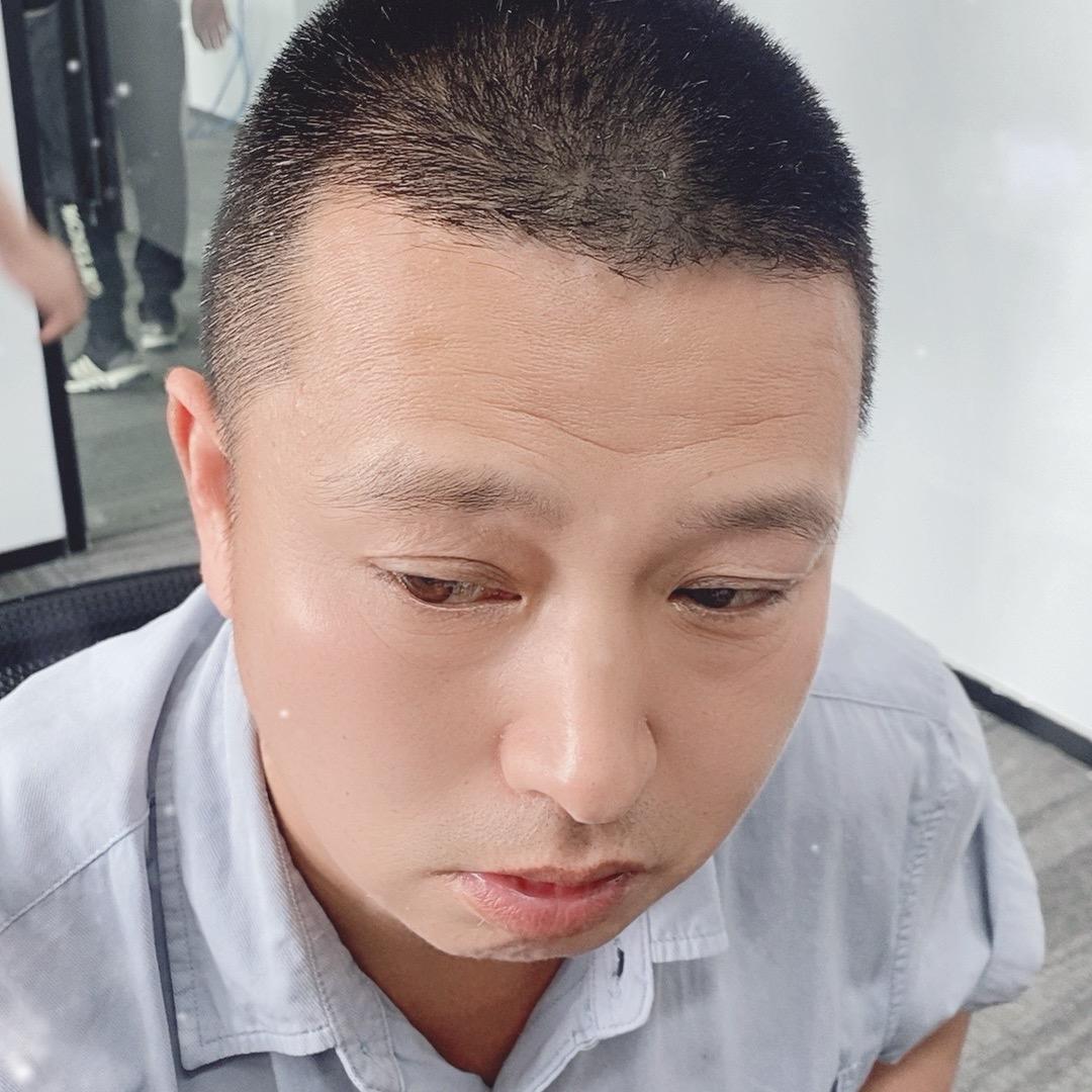 阿红