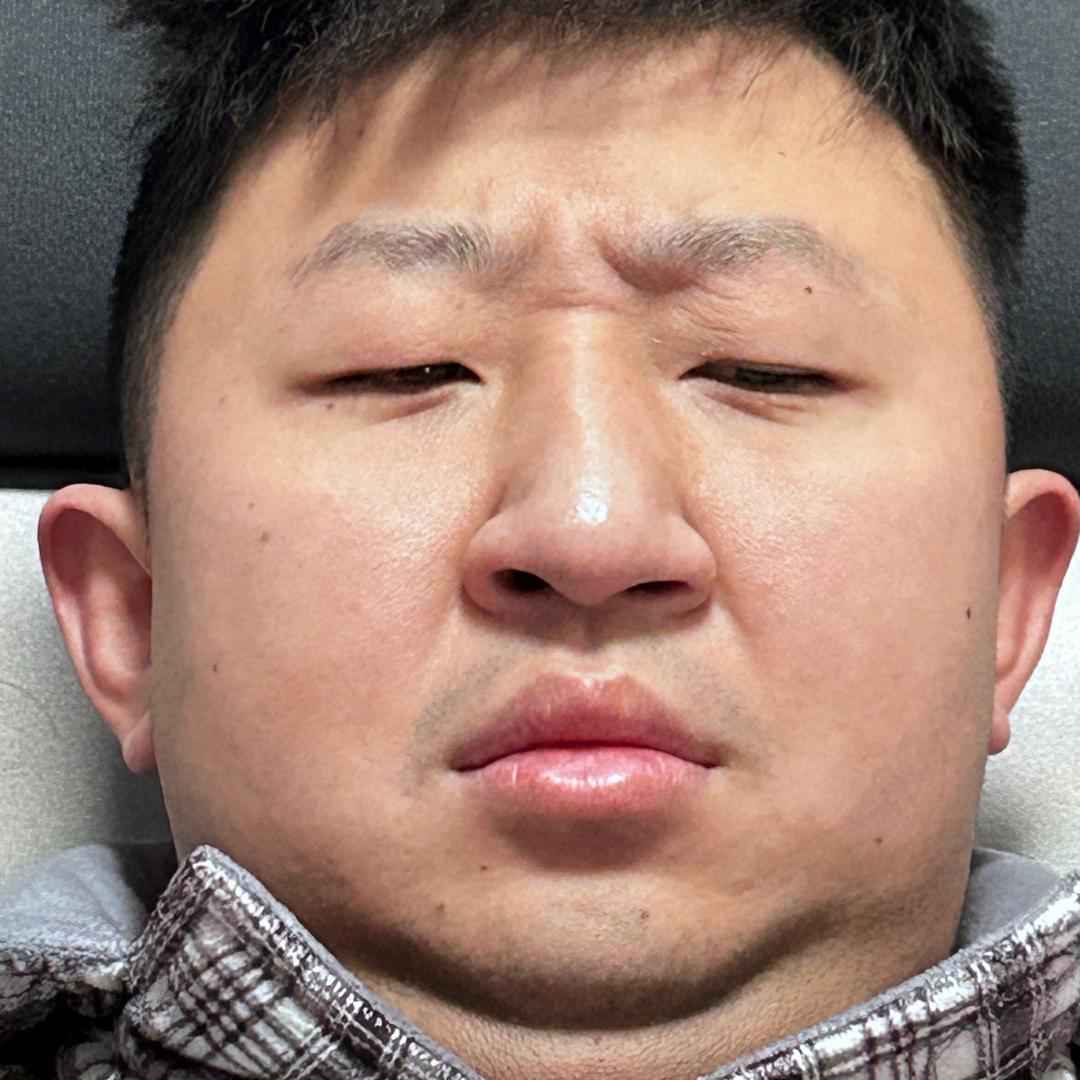 土包子👀