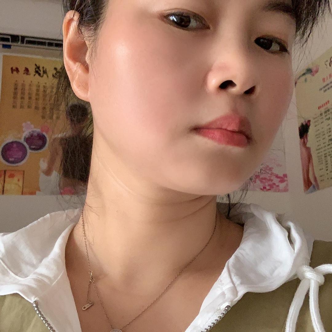丽妍问题性皮肤管理，斑敏痘芳姐