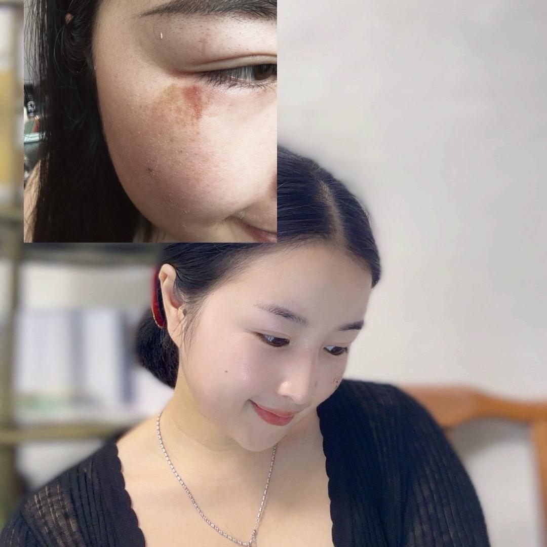忧喜