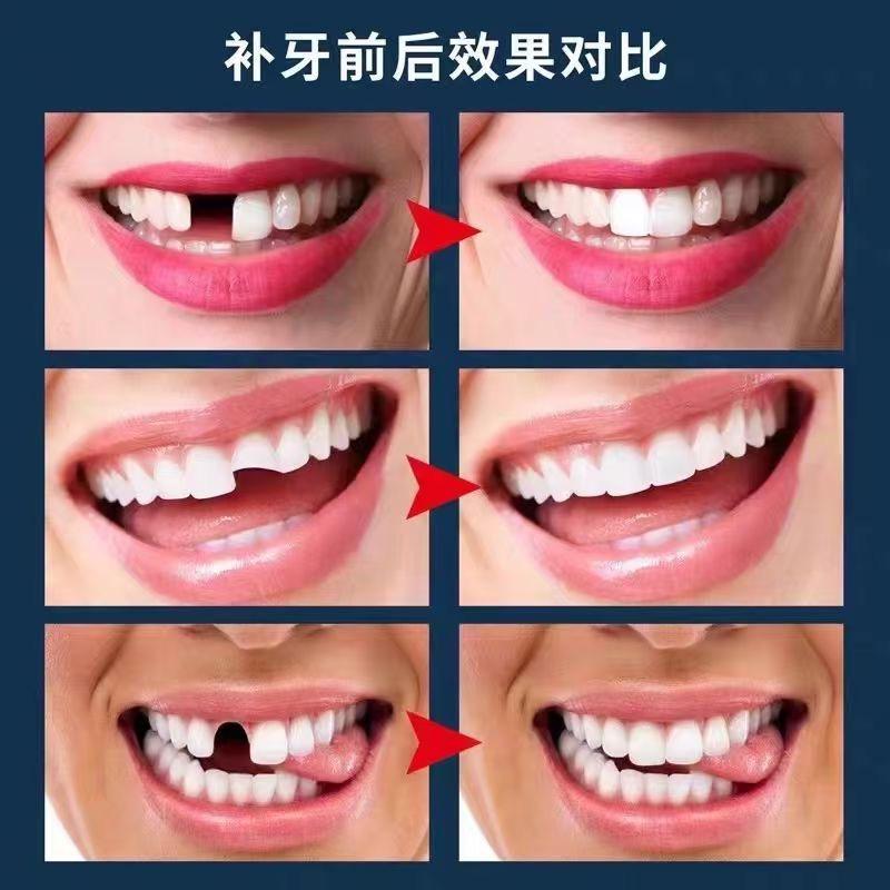牙齿知识分享