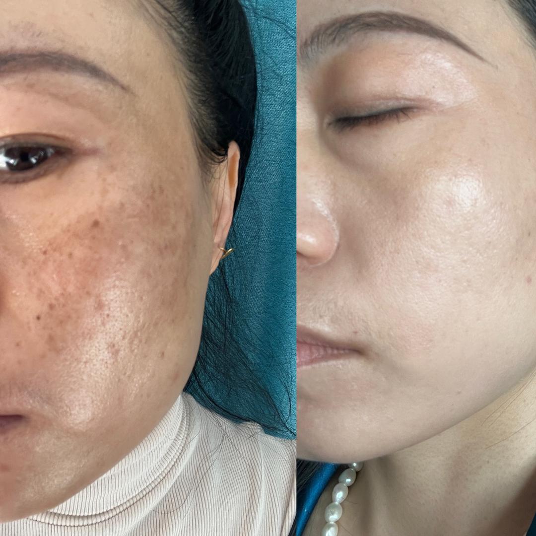 王颖专做白透亮素颜肌