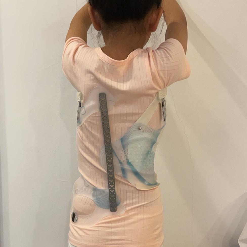 戴支具的小女孩