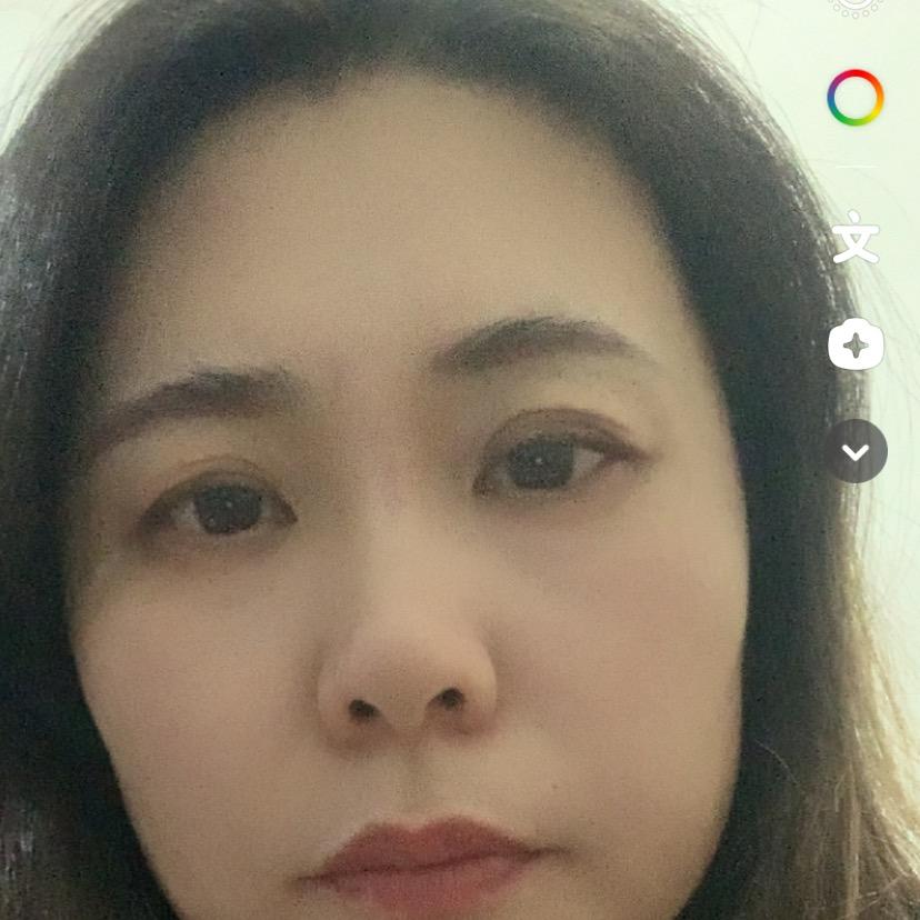 环