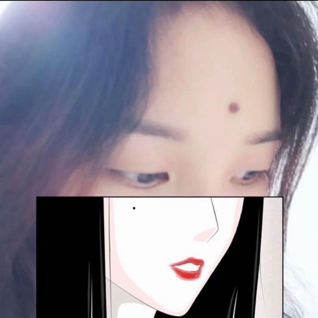 美人痣