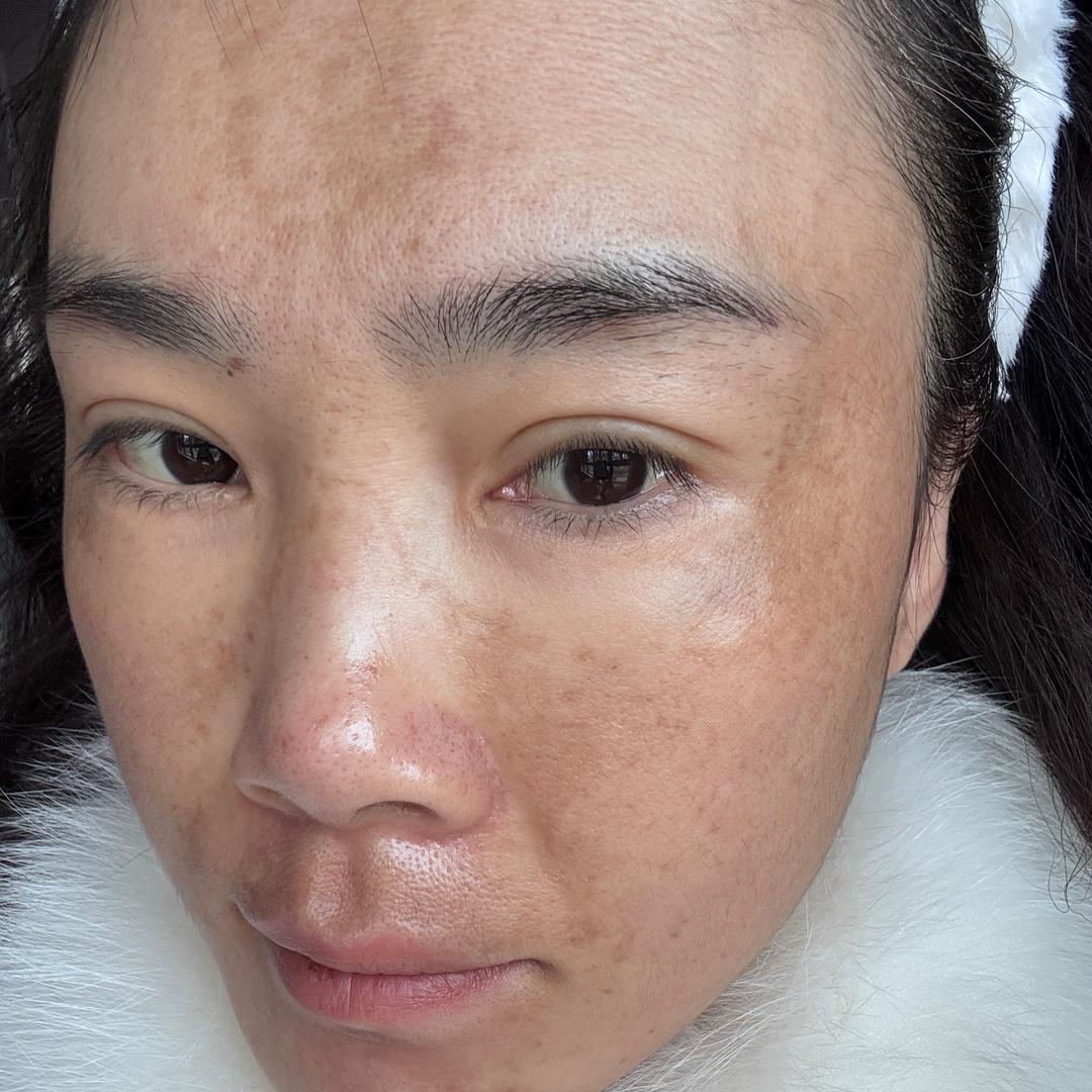 玲玲的护肤日记