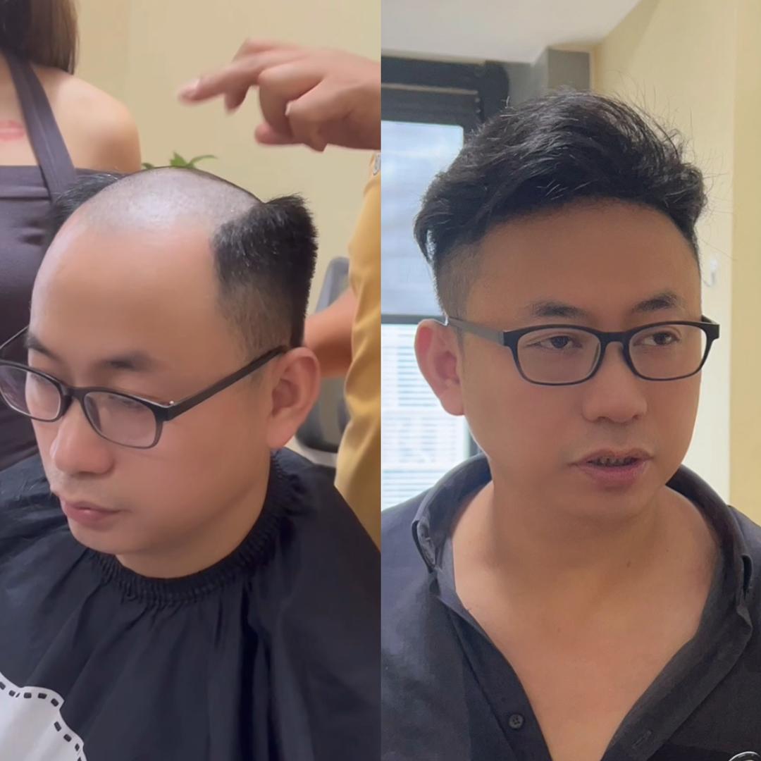 蕲春私人定制假发补发（可上门定制）