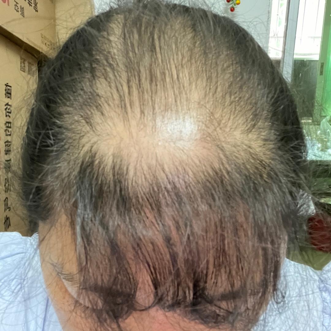 豆豆养发记