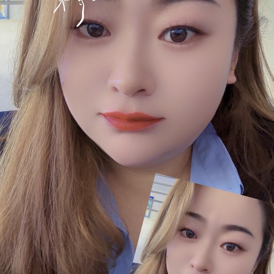 y独宠y