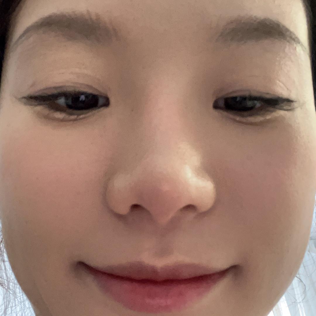 包子