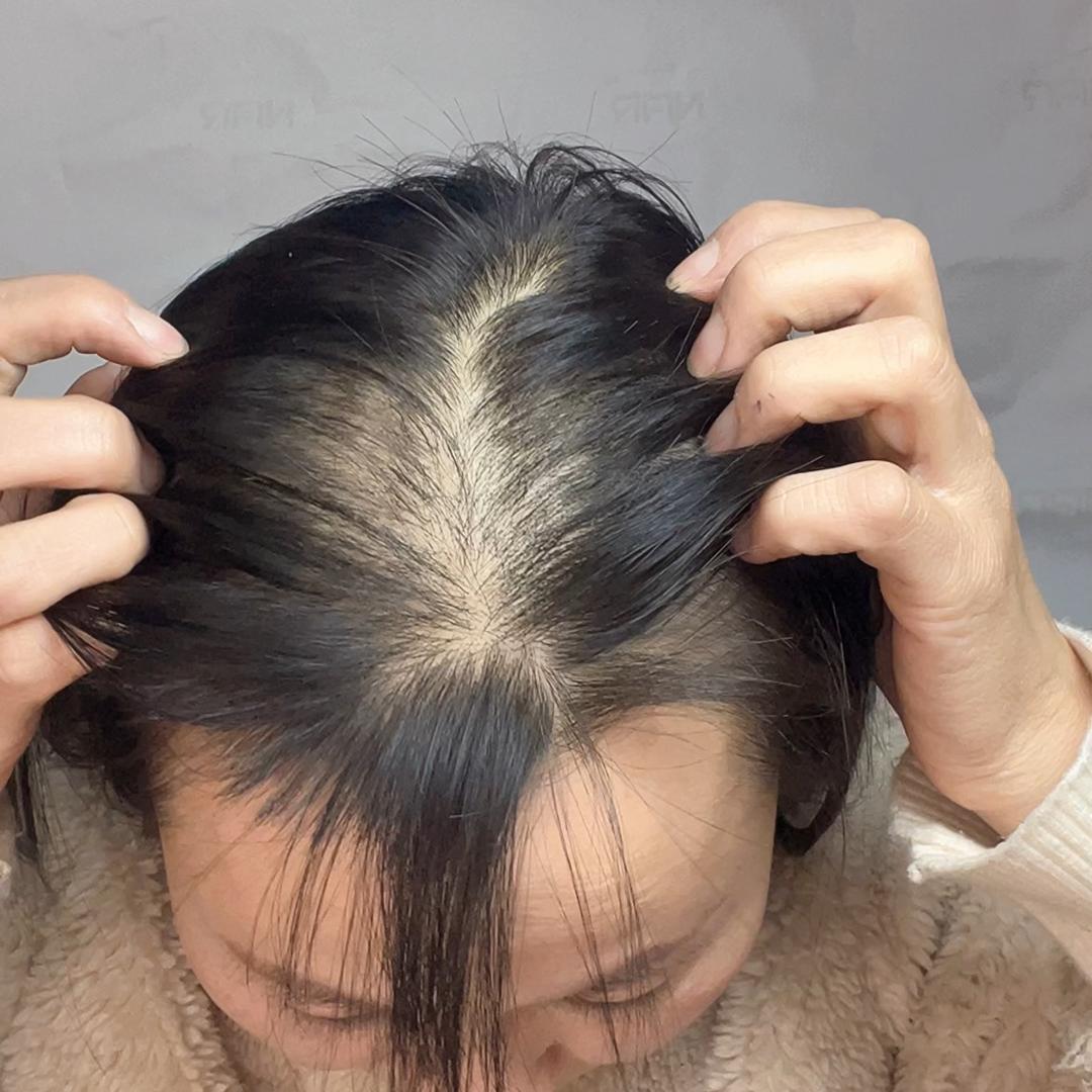 秃头霞姐养发中